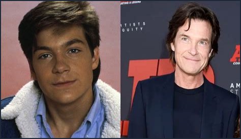 Jason Bateman Plastic Surgery Before and After