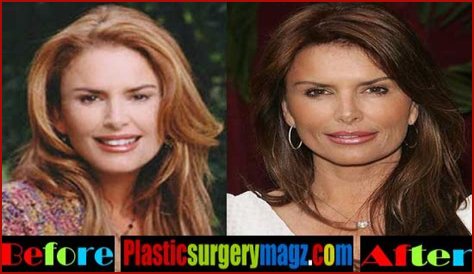 Roma Downey Plastic Surgery Before and After